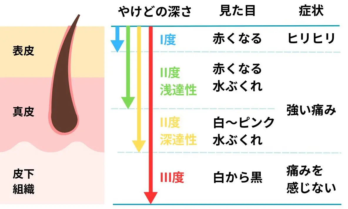 やけど（熱傷）・外傷（切り傷）｜海老名皮膚科・美容皮膚科